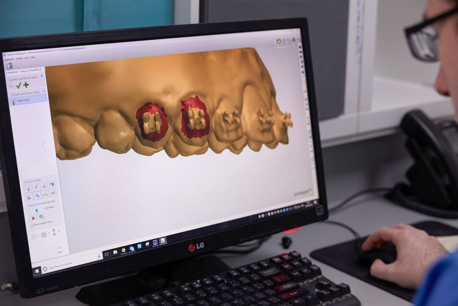 3D-принтер Formlabs Form 3B